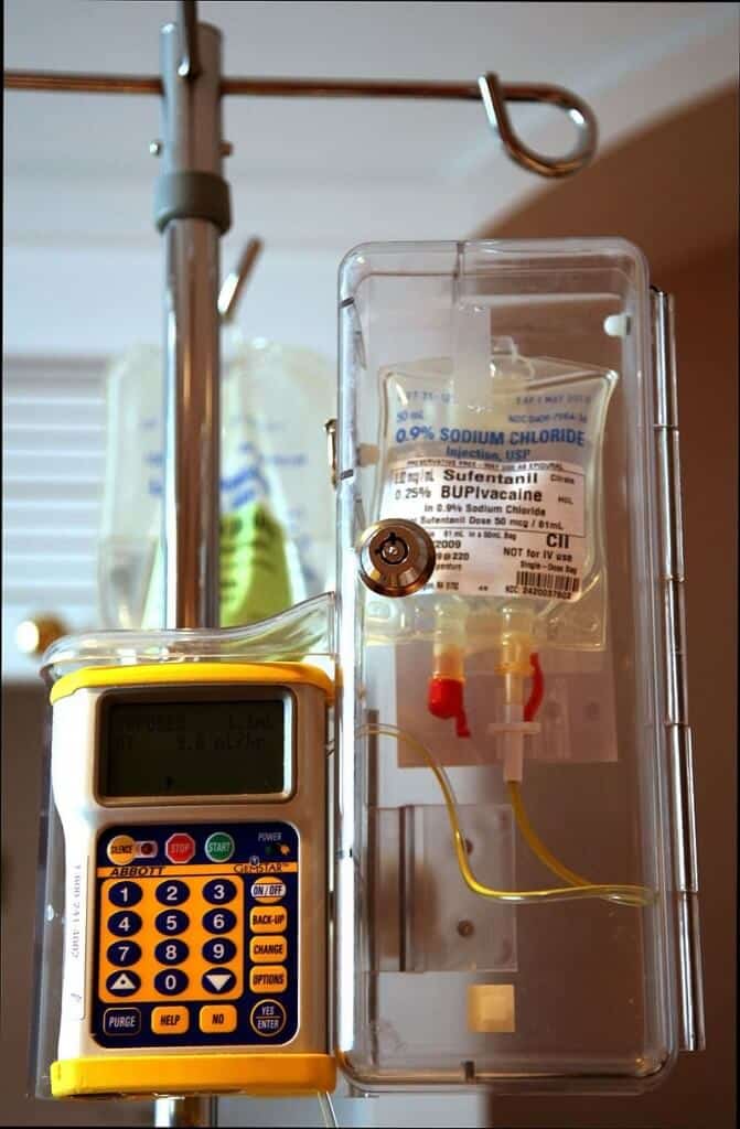 Epidural 2